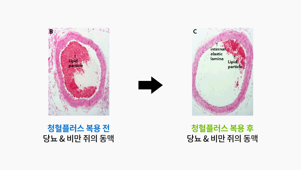 청혈플러스의 항이상지질혈증 효과